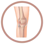 Knee-Pain-1